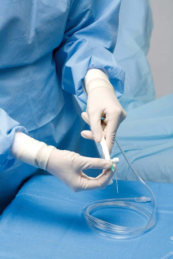 Set d'irrigation manuel